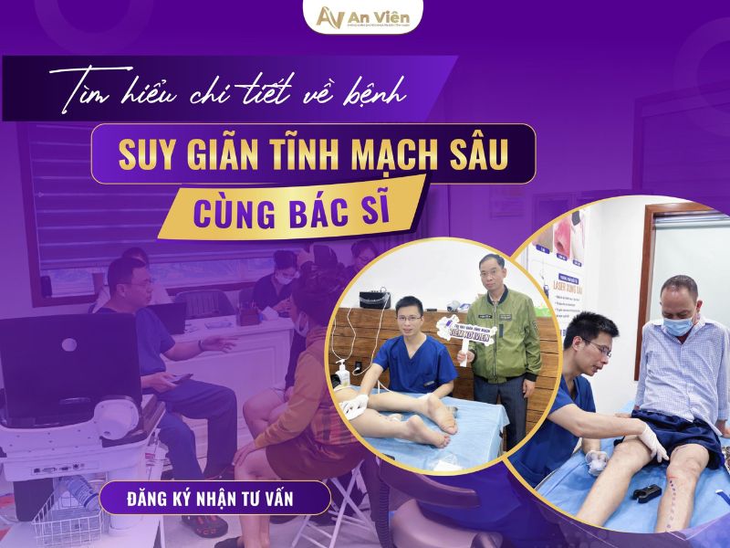 giãn tĩnh mạch triệu chứng