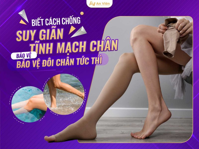 giãn tĩnh mạch triệu chứng