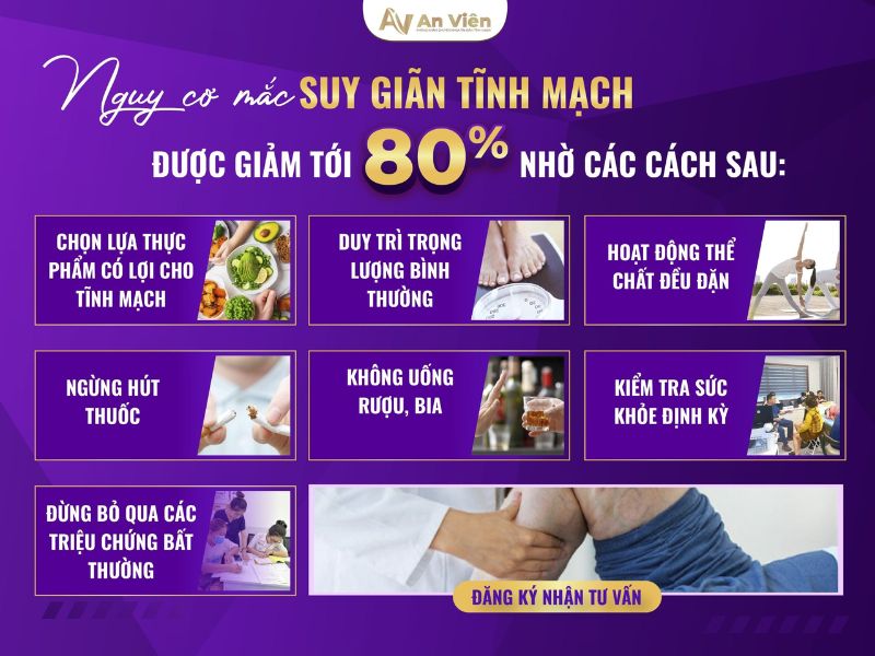phòng chống giãn tĩnh mạch