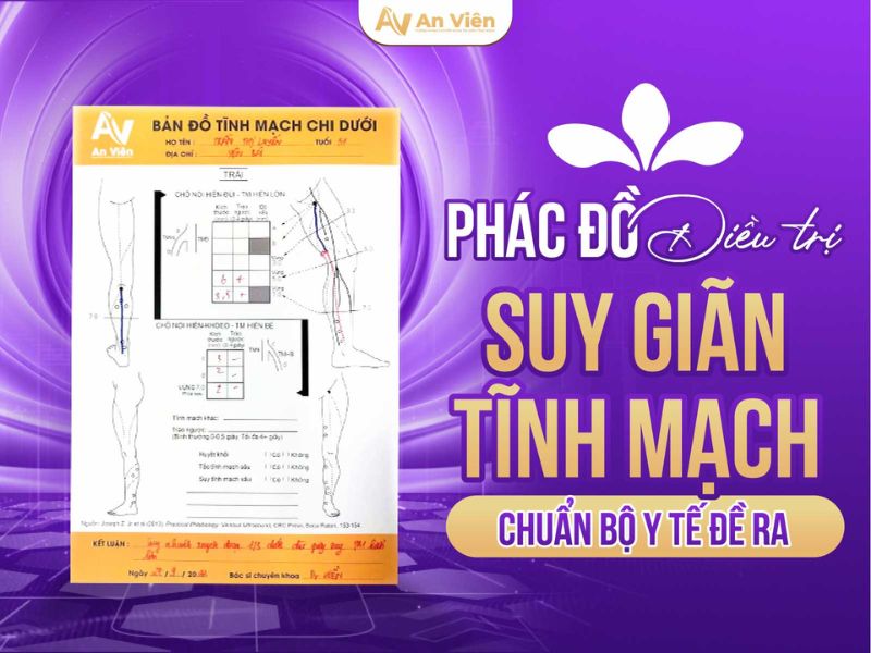suy giãn tĩnh mạch chân cách điều trị