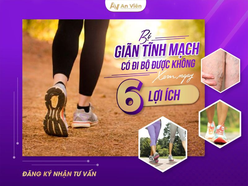 suy giãn tĩnh mạch có đi bộ được không