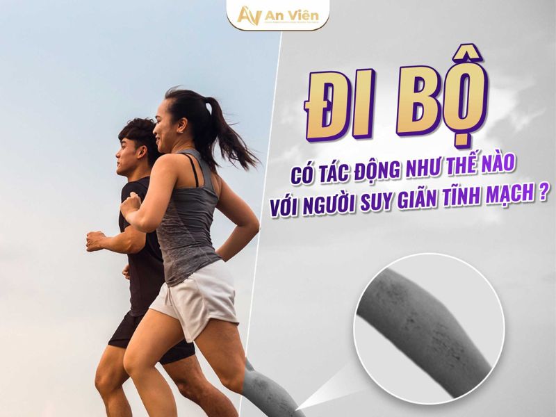 suy giãn tĩnh mạch có đi bộ được không