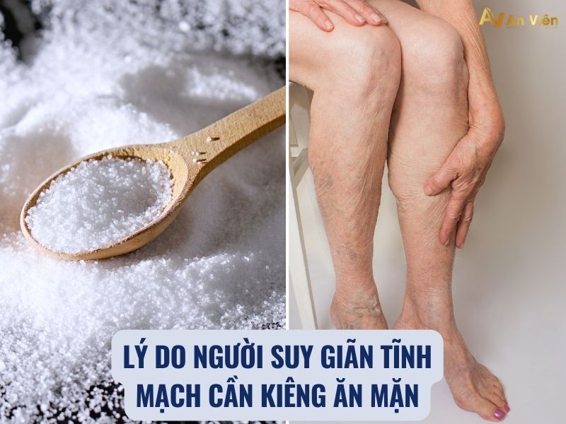 tại sao giãn tĩnh mạch