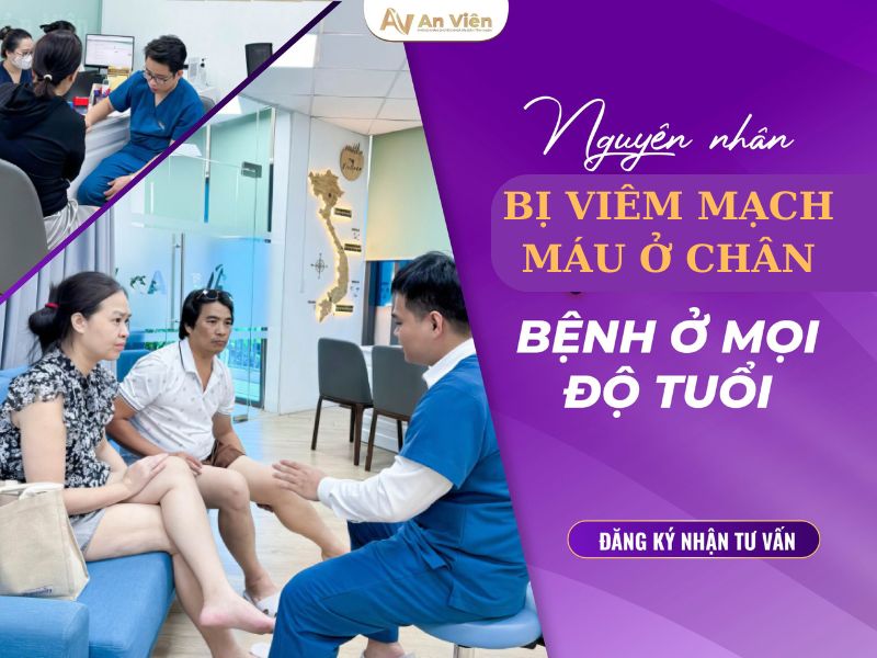 viêm mạch máu ở chân
