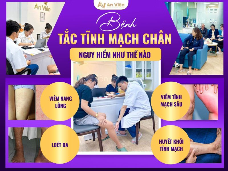 bệnh tắc tĩnh mạch chân