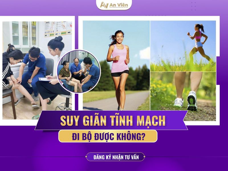 biểu hiện của giãn tĩnh mạch chân