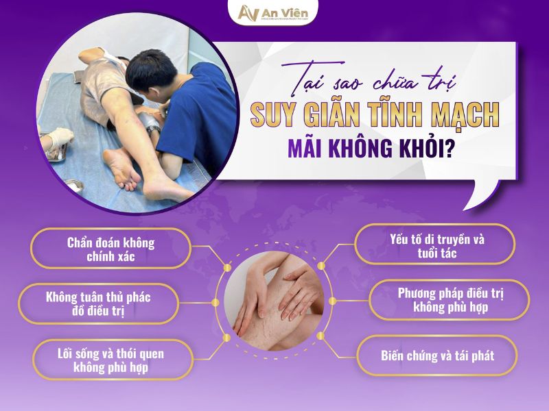 chữa trị suy giãn tĩnh mạch