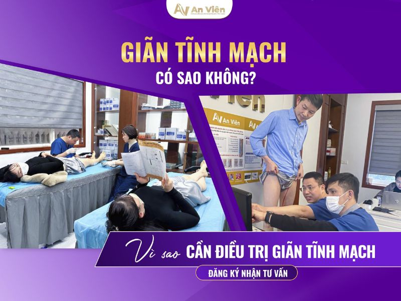 chữa trị suy giãn tĩnh mạch