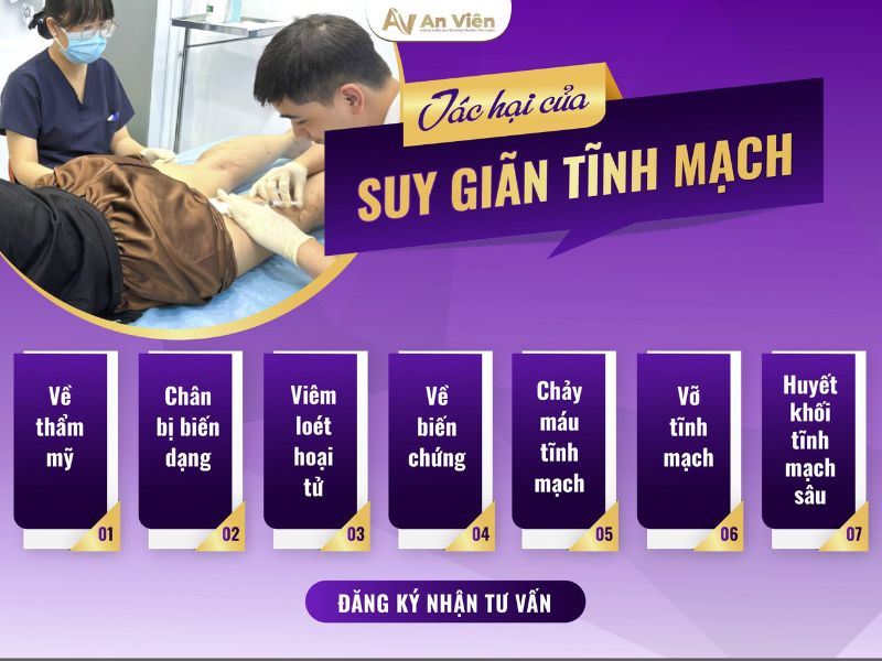 chữa trị suy giãn tĩnh mạch