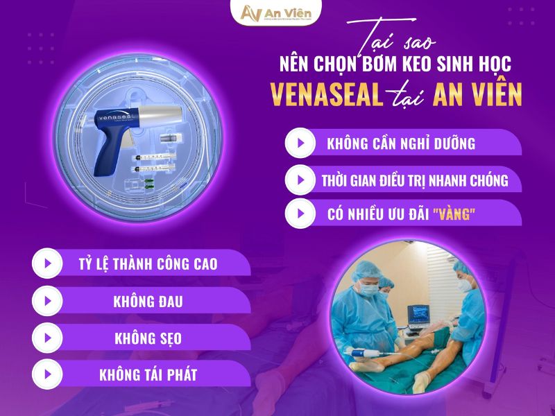 chữa trị suy giãn tĩnh mạch