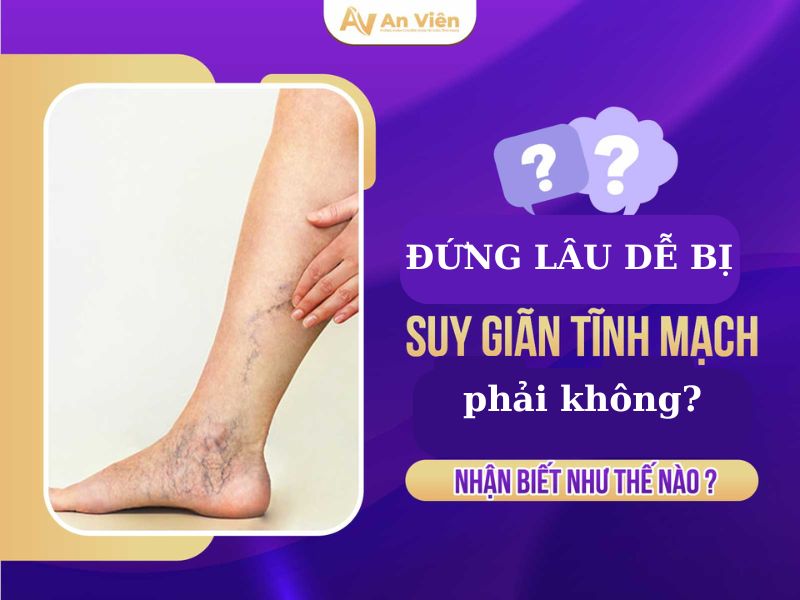 đứng lâu máu dồn xuống chân