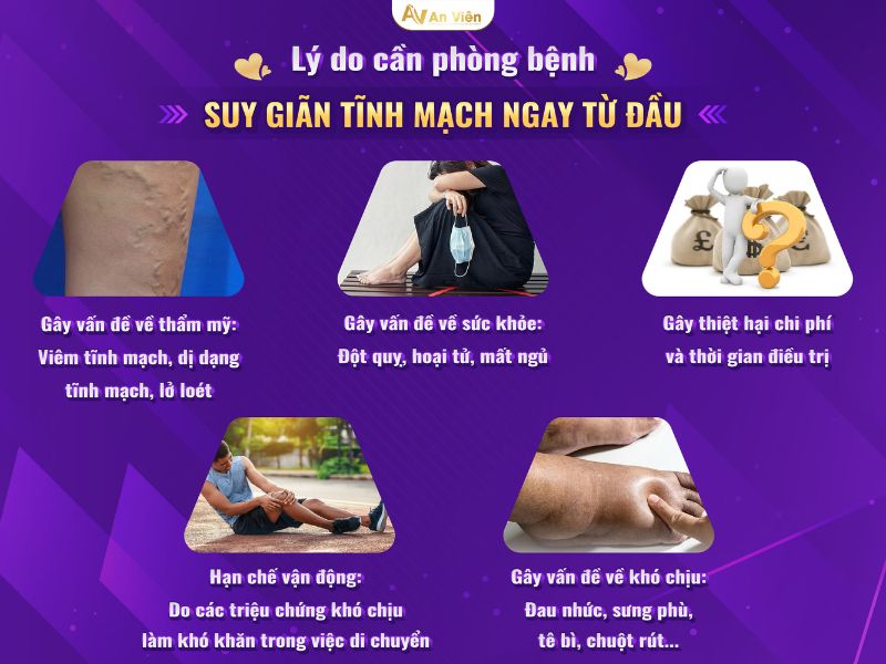 giãn tĩnh mạch ở đùi