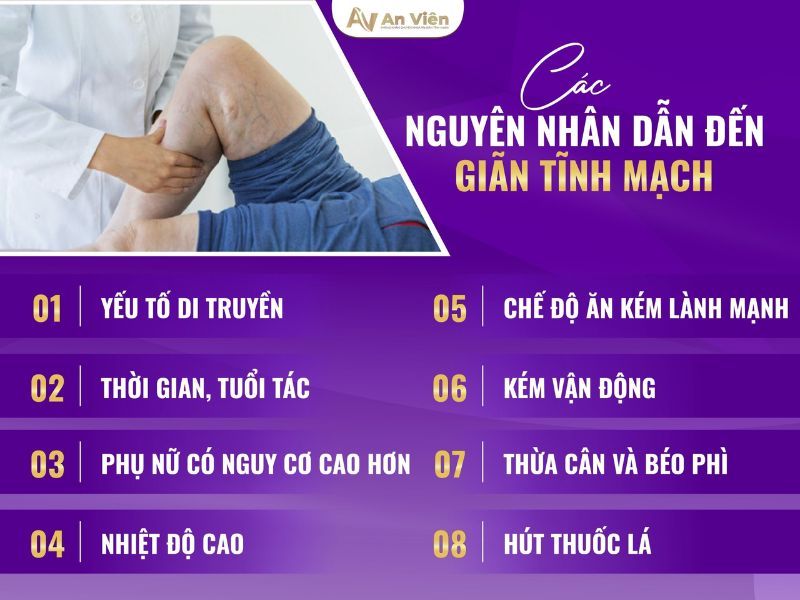 hình ảnh chân bị giãn tĩnh mạch