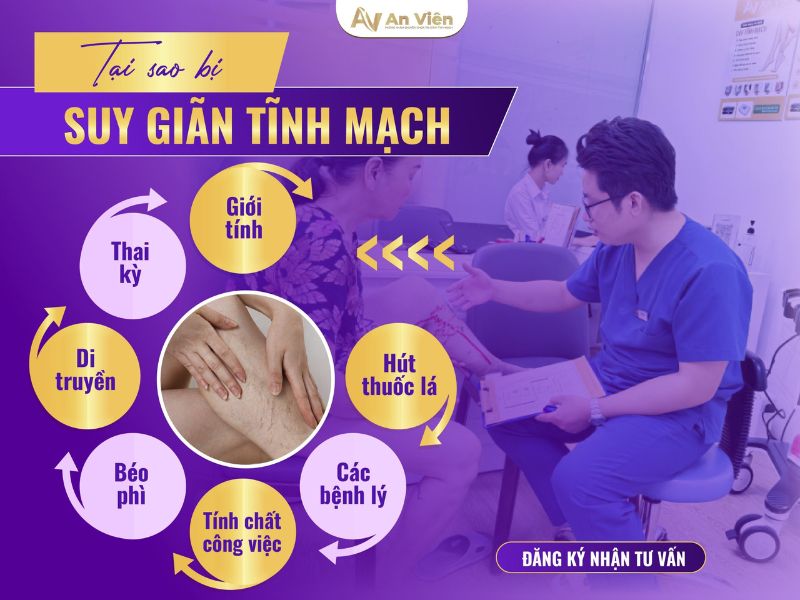 lý do bị giãn tĩnh mạch chân