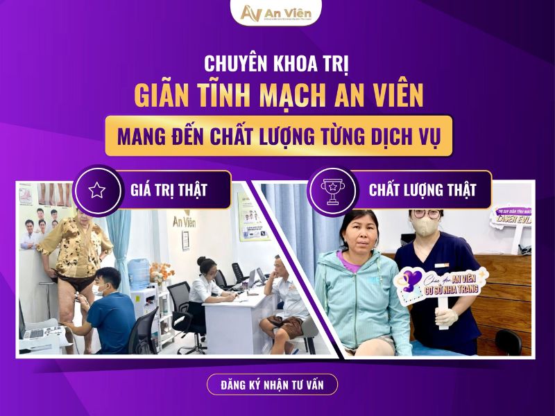 lý do bị giãn tĩnh mạch chân
