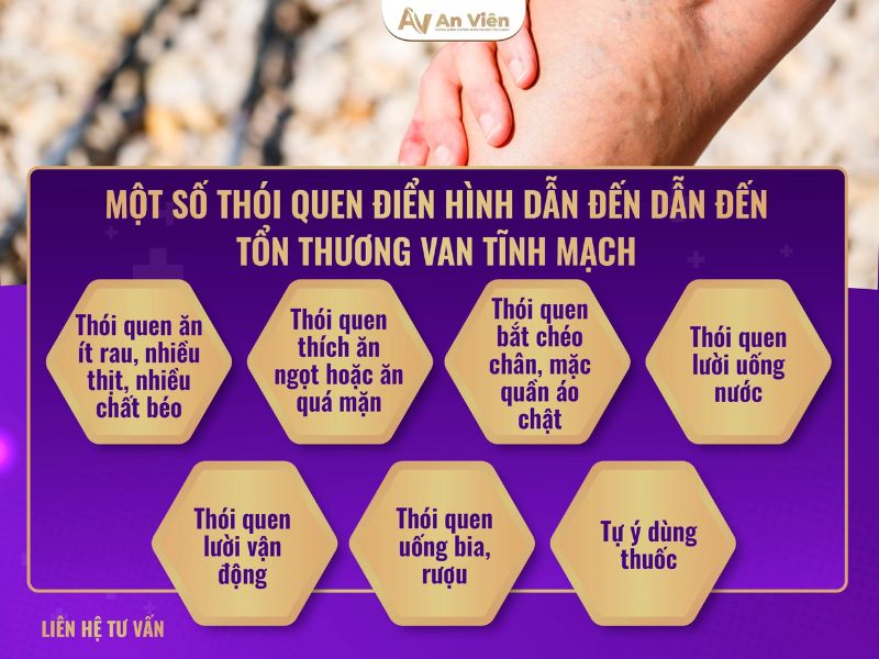 nguyên nhân bị giãn tĩnh mạch ở chân