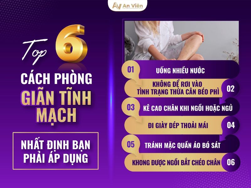 nguyên nhân bị giãn tĩnh mạch ở chân