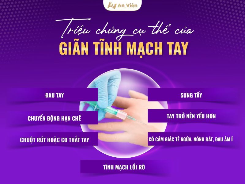 nguyên nhân giãn tĩnh mạch tay