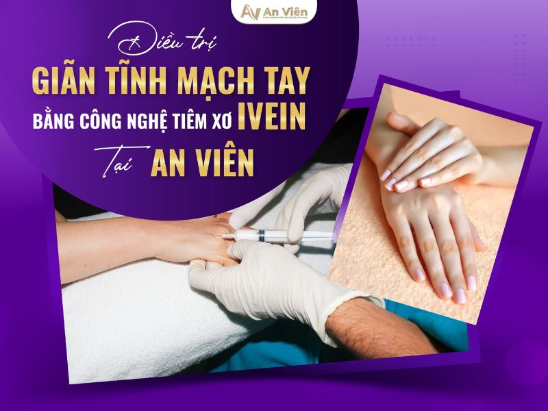 nguyên nhân giãn tĩnh mạch tay