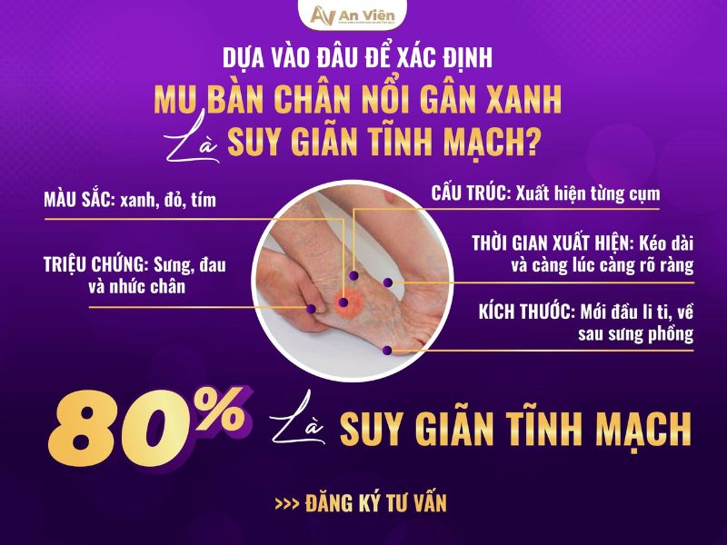 nổi nhiều gân xanh ở chân