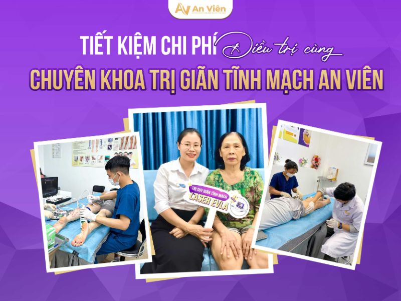 nổi nhiều gân xanh ở chân