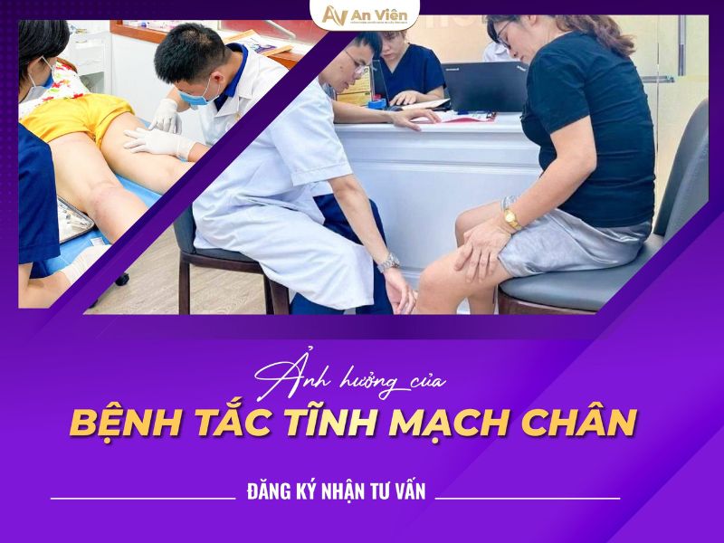 tác hại của giãn tĩnh mạch