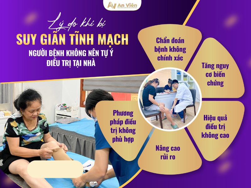 tại sao bị giãn tĩnh mạch chân