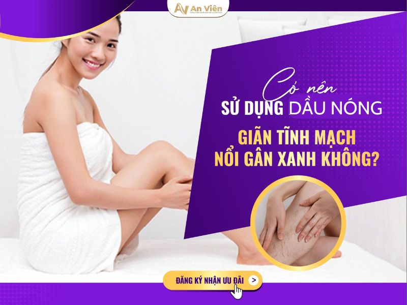 tại sao chân bị giãn tĩnh mạch