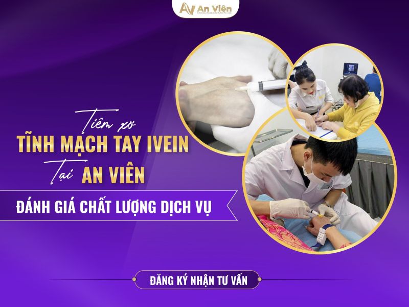 tay chân nhiều gân xanh