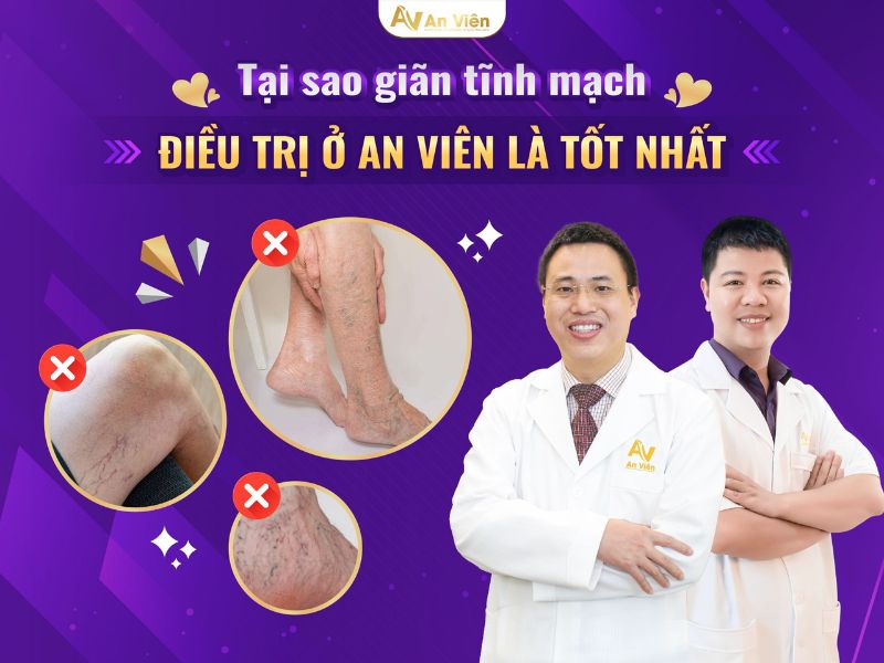 tay chân nhiều gân xanh