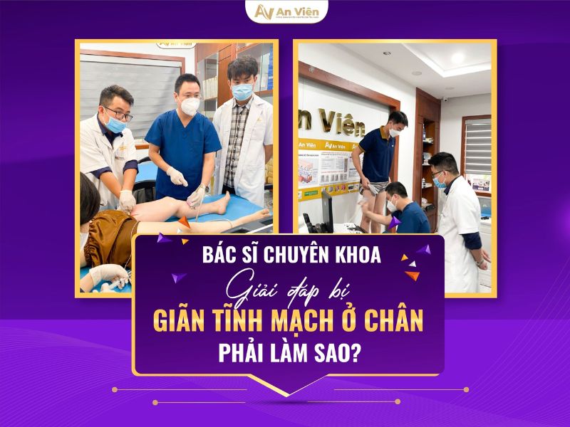 thế nào là giãn tĩnh mạch