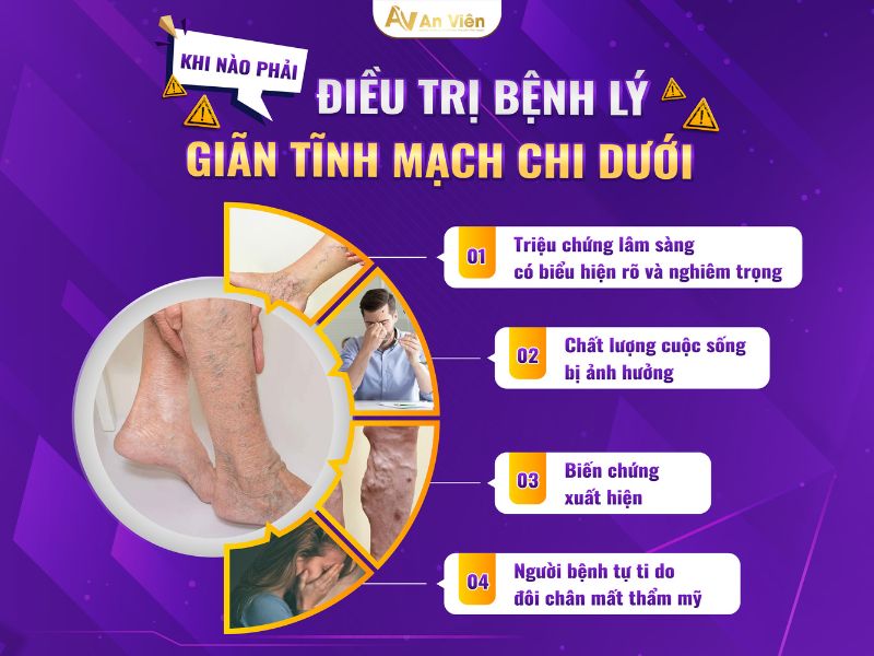 triệu chứng của suy giãn tĩnh mạch chân