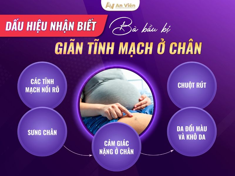 bà bầu bị giãn tĩnh mạch ở chân