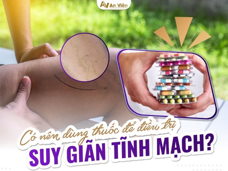 bệnh tĩnh mạch chân