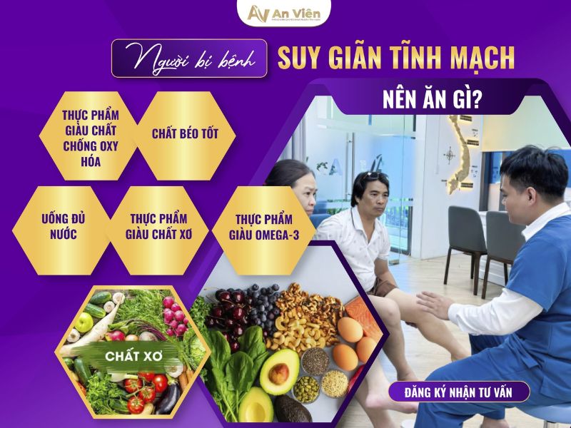 biểu hiện suy giãn tĩnh mạch "