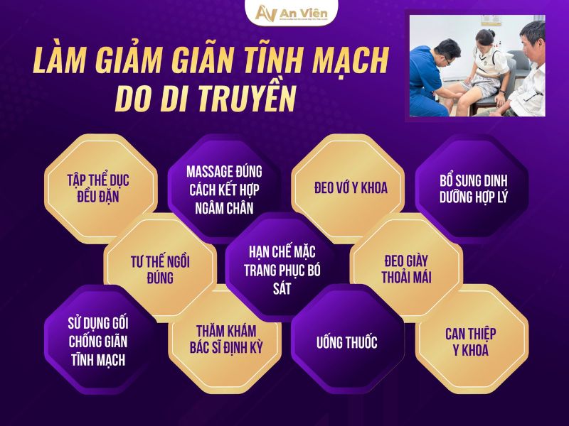 cách làm giảm suy giãn tĩnh mạch