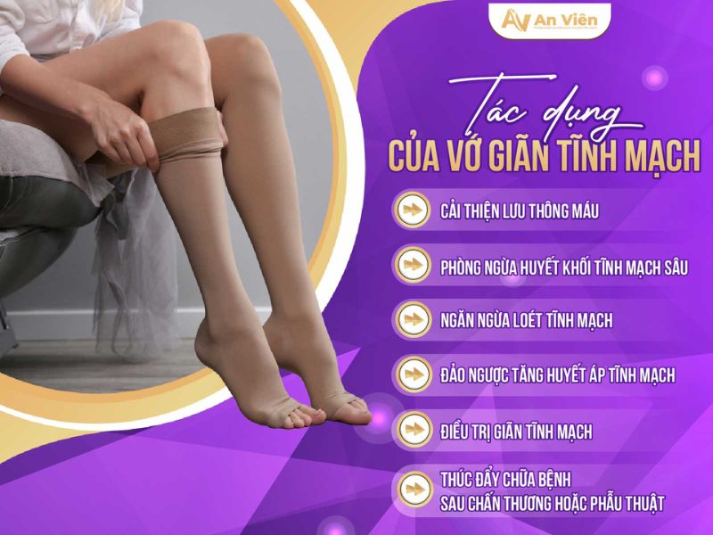 cách làm giảm suy giãn tĩnh mạch