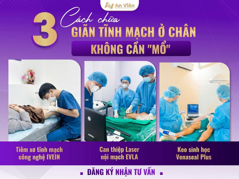 đau giãn tĩnh mạch chân