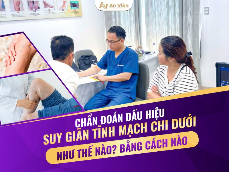 giãn tĩnh mạch có trị hết không