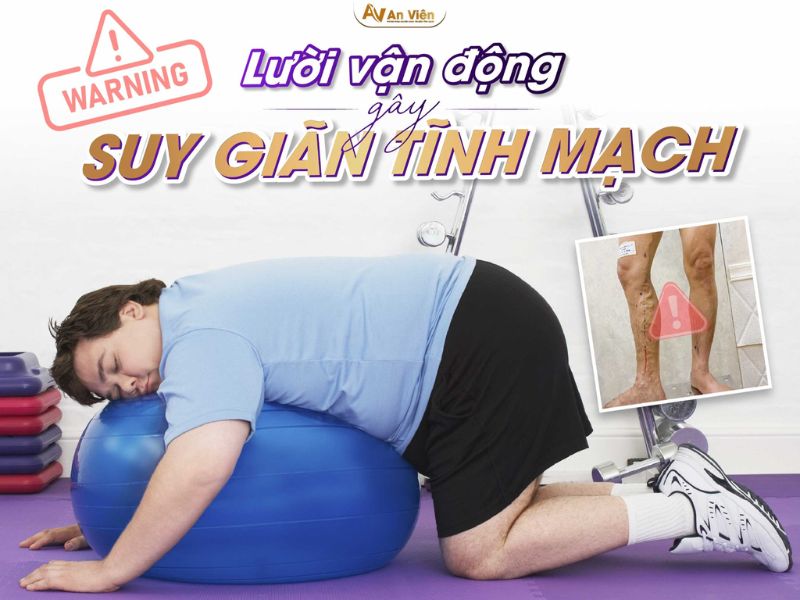 lý do bị giãn tĩnh mạch chân