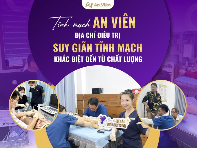 lý do bị giãn tĩnh mạch chân