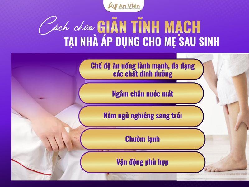 giãn tĩnh mạch sau sinh