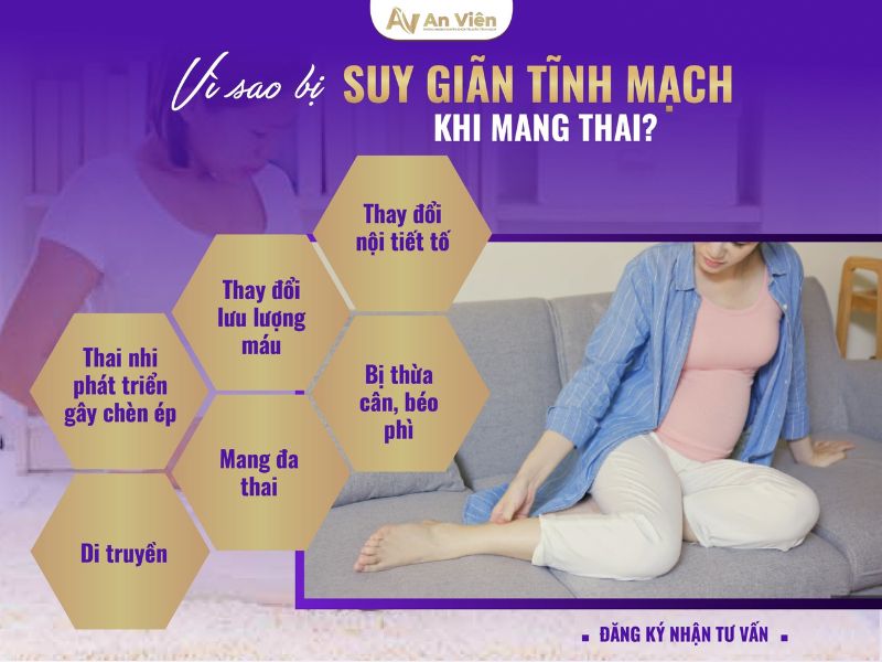 giãn tĩnh mạch sau sinh