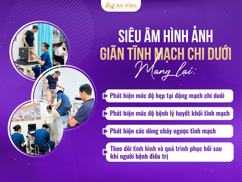hình ảnh giãn tĩnh mạch chi dưới