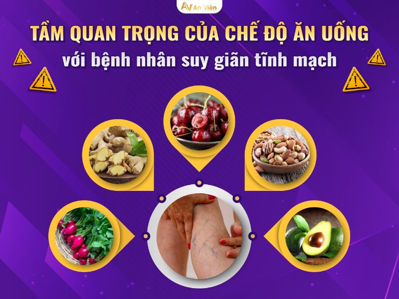 ngăn ngừa giãn tĩnh mạch