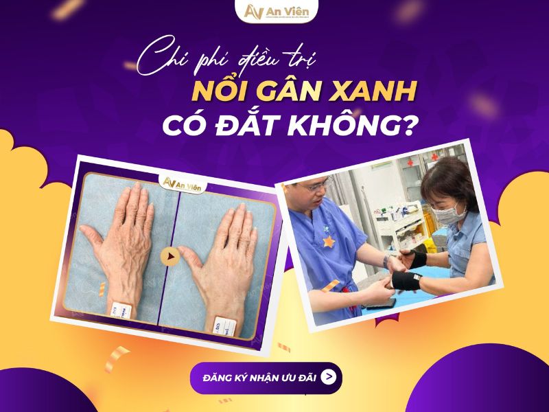 nổi tĩnh mạch ở tay