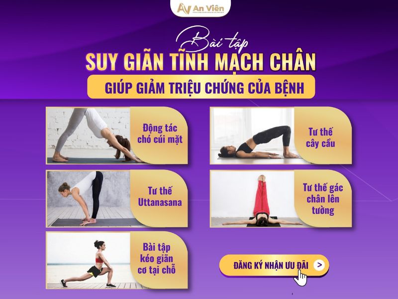 phình mạch máu ở chân