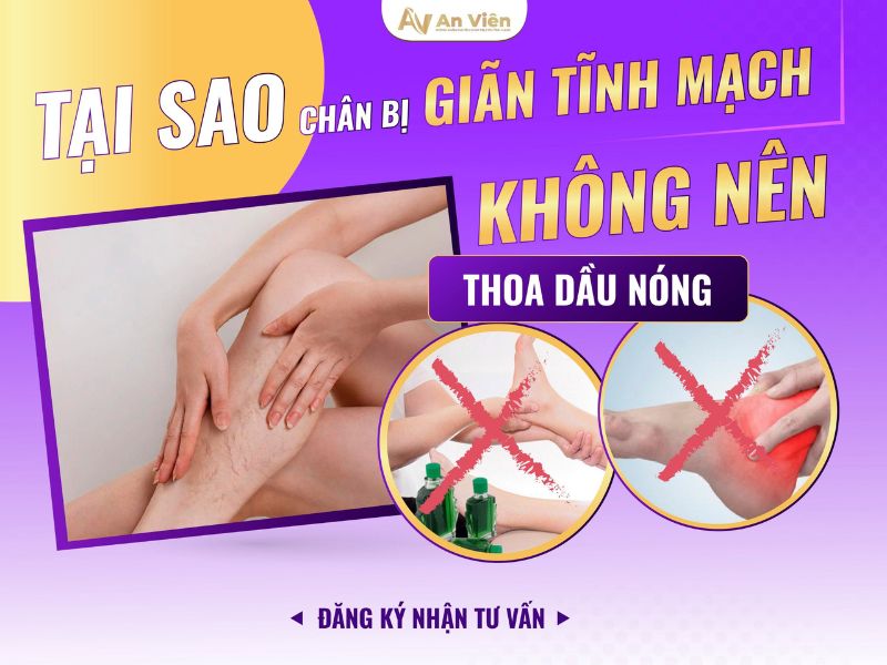 phòng suy giãn tĩnh mạch chân