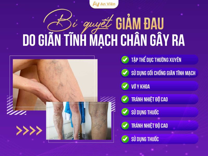 phòng suy giãn tĩnh mạch chân