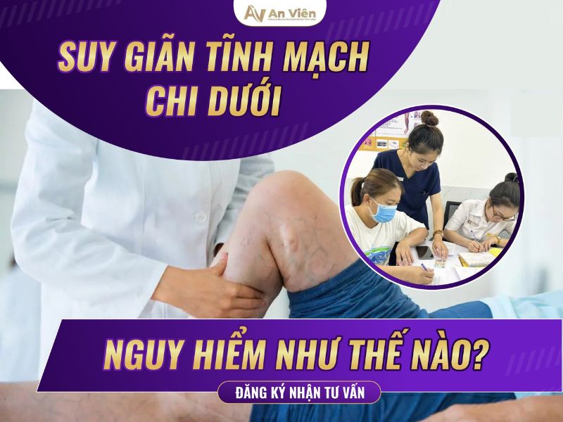 suy giảm tĩnh mạch chi dưới
